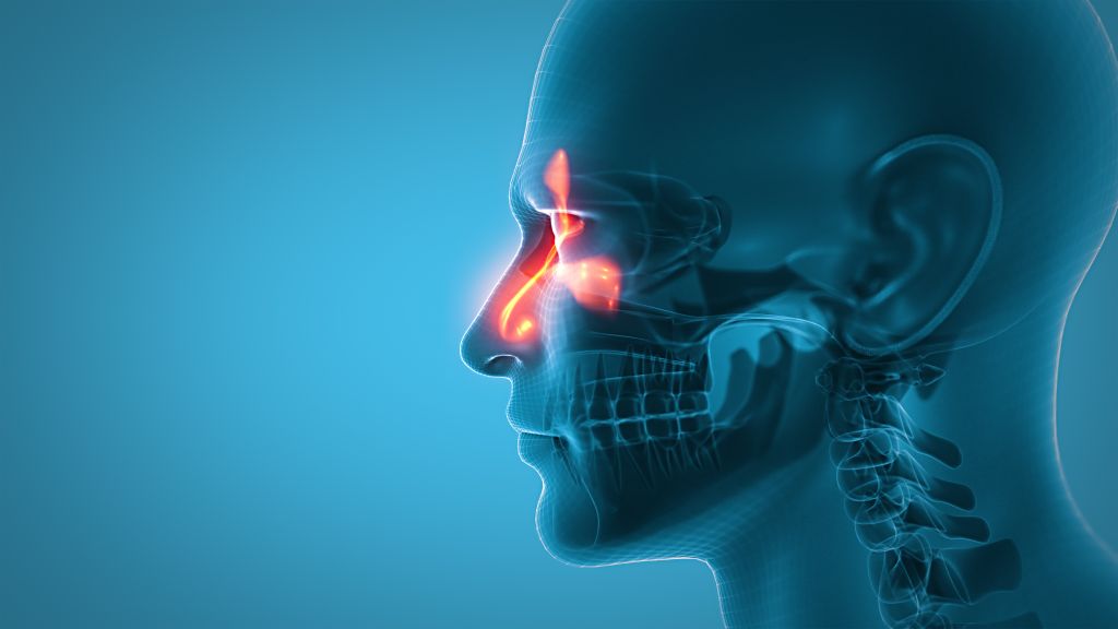 Sinus cavity concept 