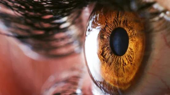 What Causes Dry Eyes?