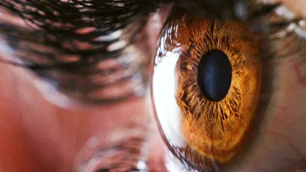 What Causes Dry Eyes?