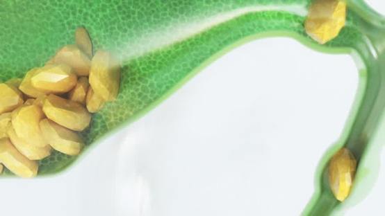 Use Bile Salts for SIBO (Small Intestinal Bacterial Overgrowth)