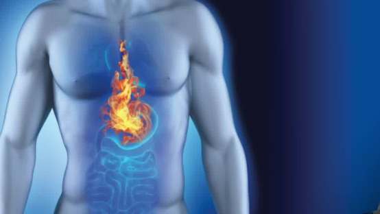 Your Quick Guide to Conquering Acid Reflux