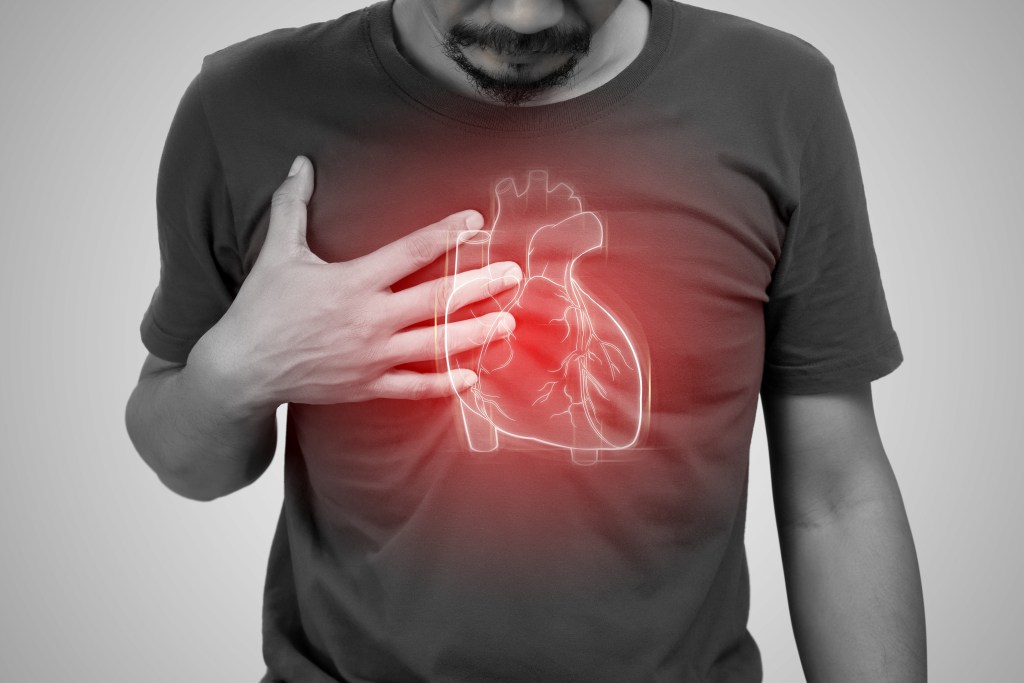Heart issues illustration