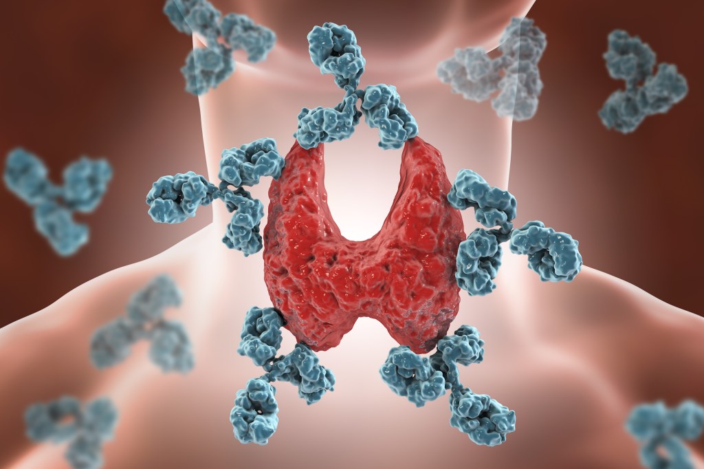 Hashimoto's disease concept