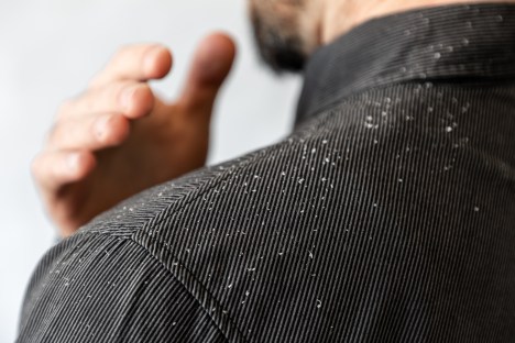 4 Remedies for Dandruff You Can Try at Home