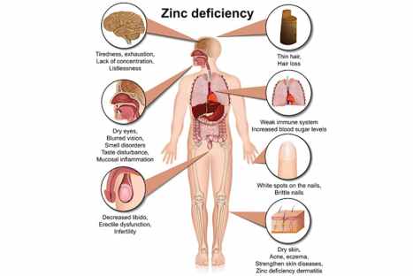 Key Reasons For a Zinc Deficiency