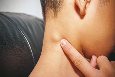 What Is a Lymph Node