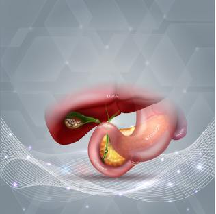 Will Intermittent Fasting Cause Gallstones