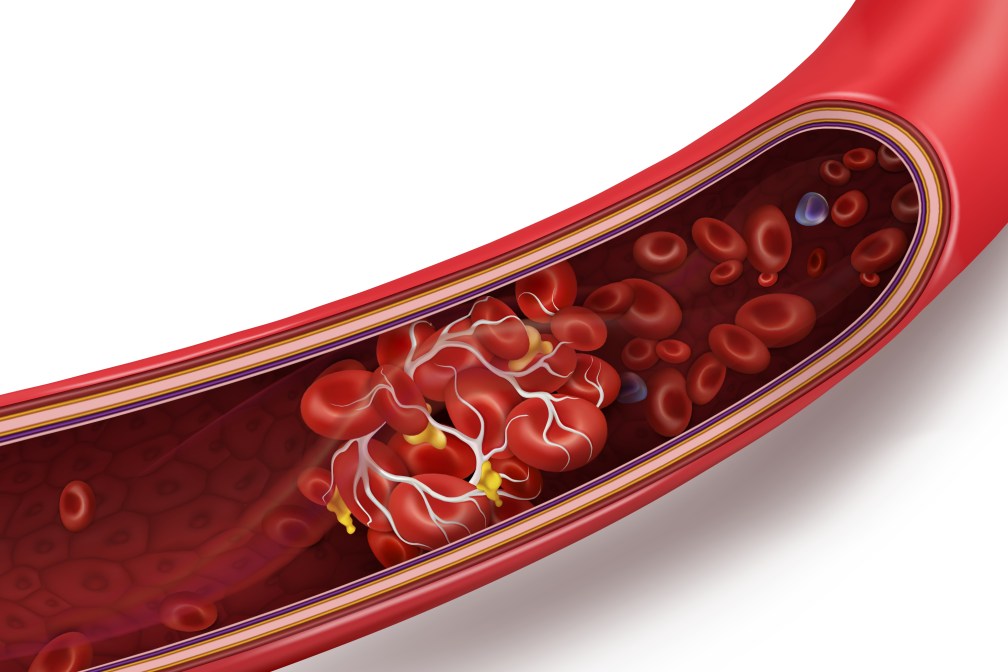 Top 6 Natural Blood Thinners