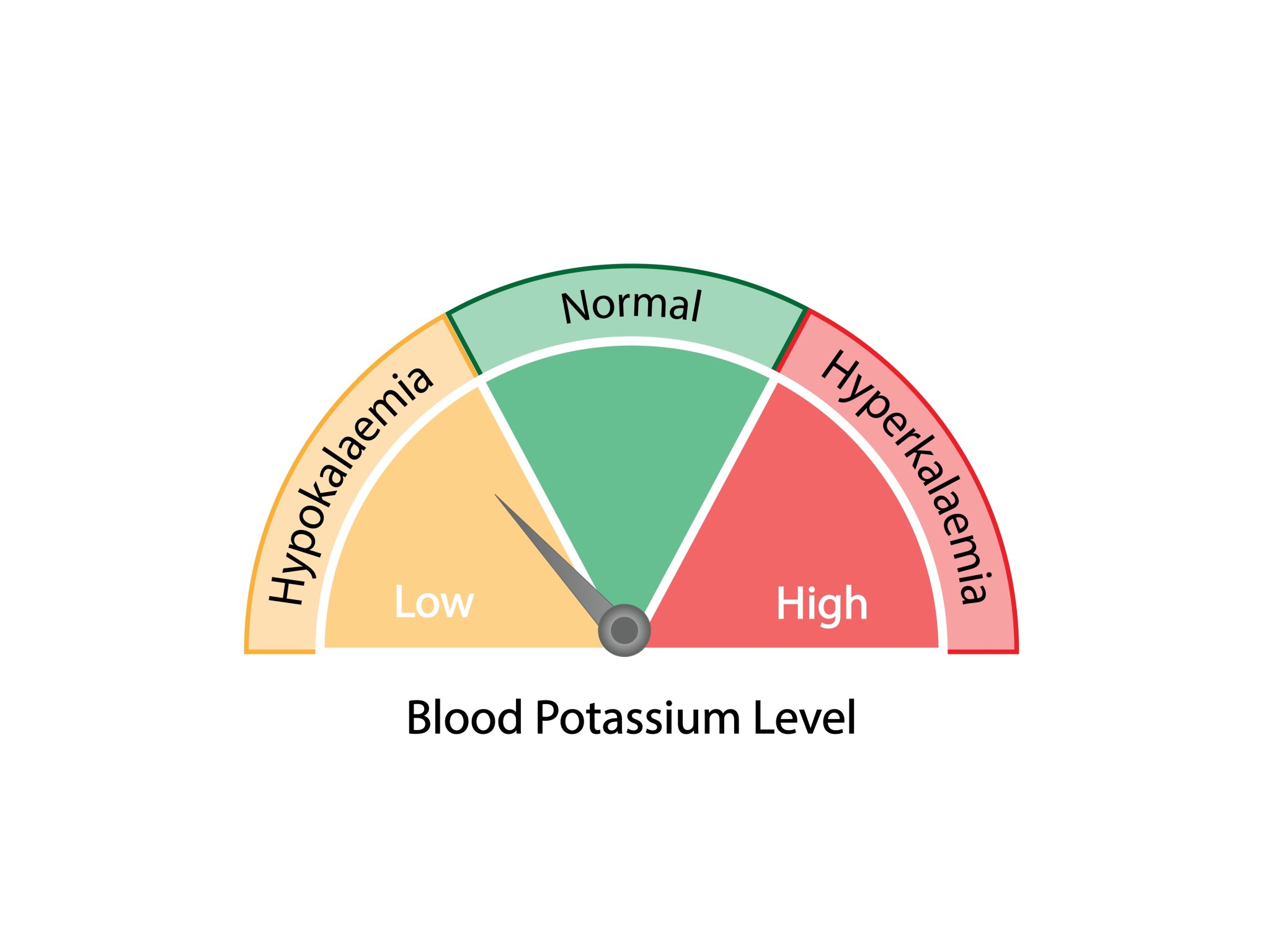 Sodium Potassium Ratio – Guide to Optimal Health | Dr. Berg