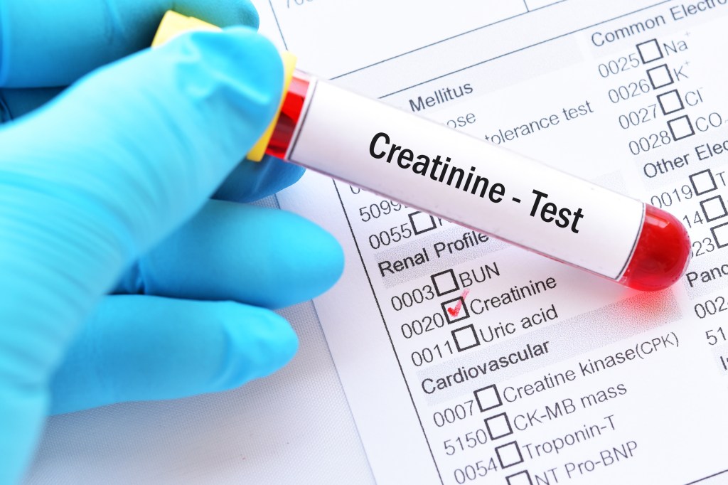 Creatinine blood marker