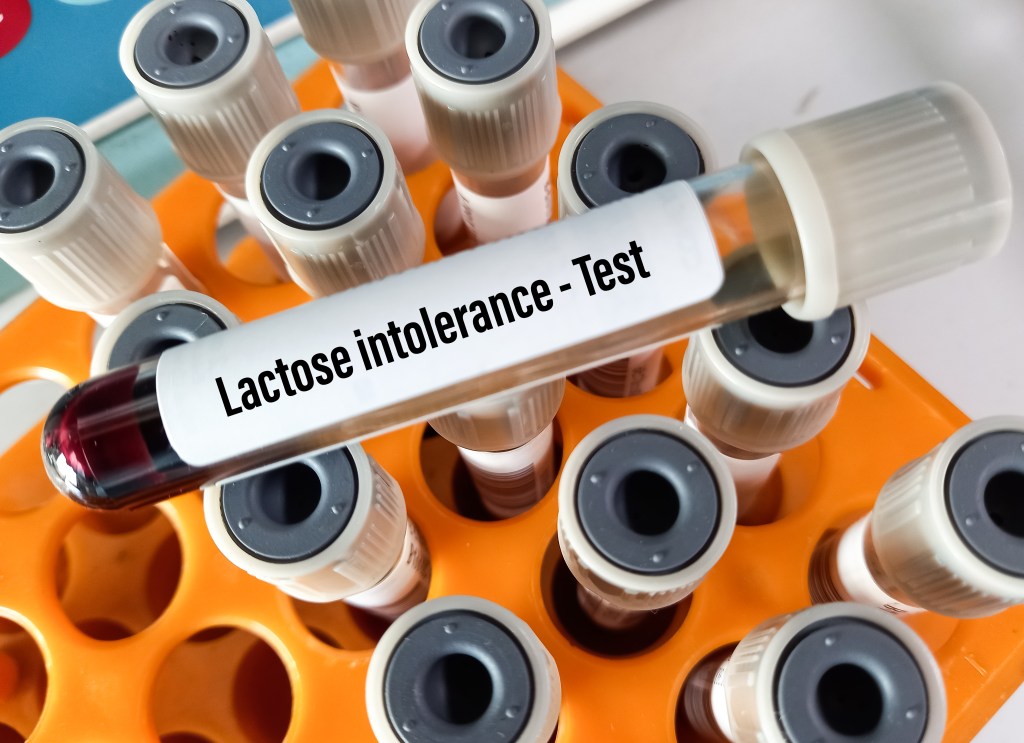 Lactose intolerance test