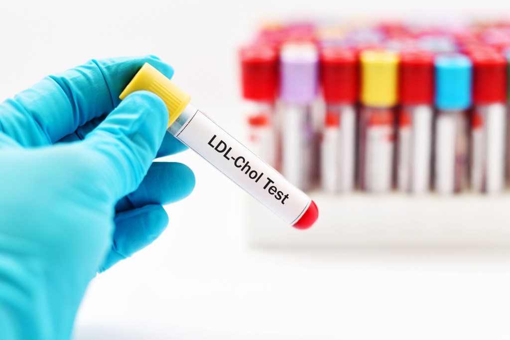 Blood test