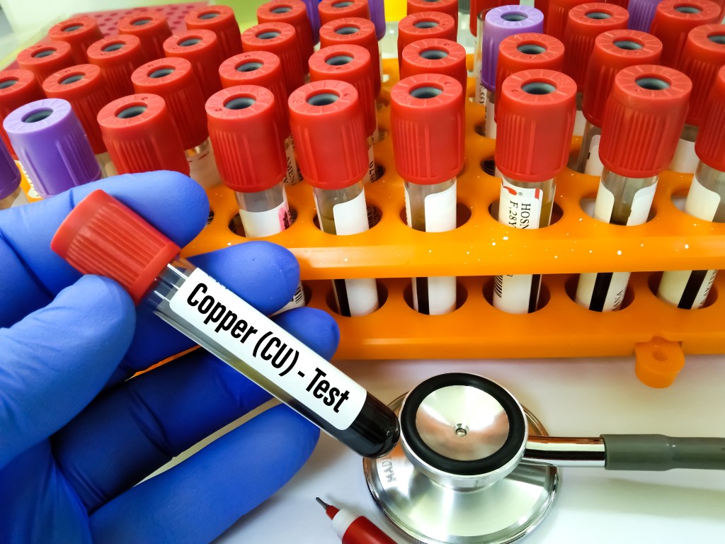 Copper test blood sample
