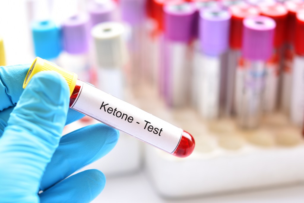 Ketone blood test
