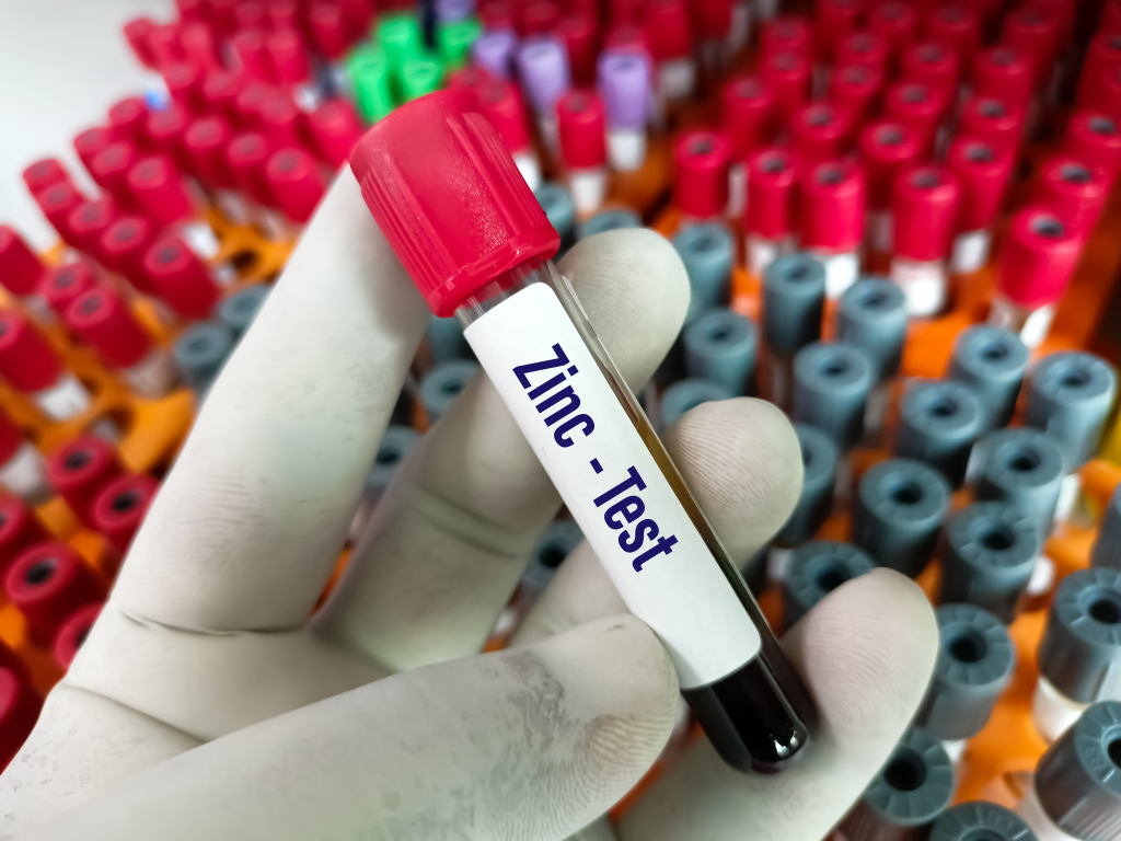 Zinc blood test