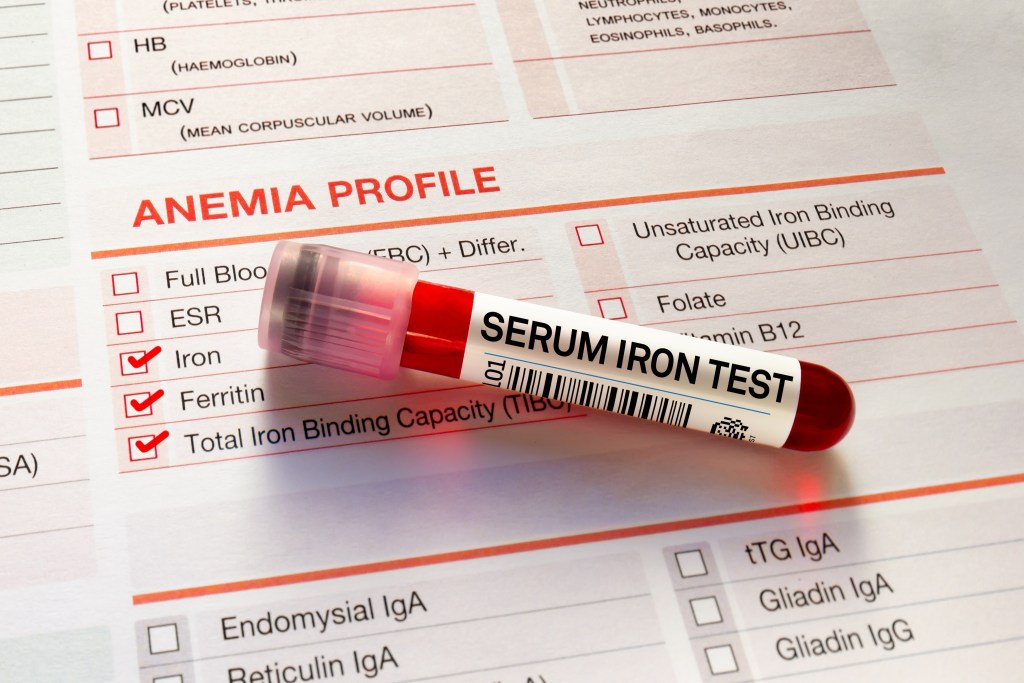 iron deficiency anemia blood test