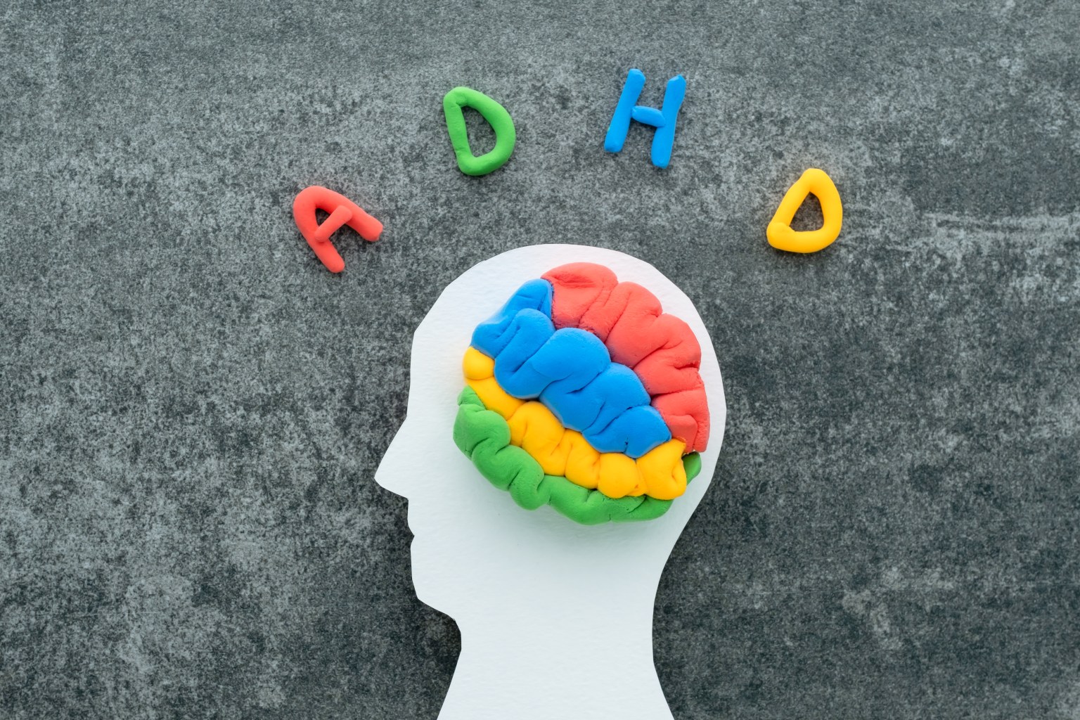 ADHD brain