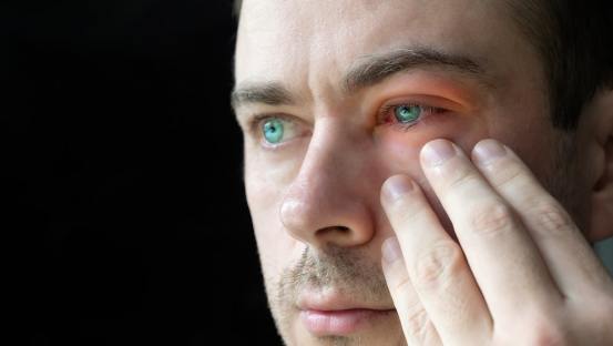 Colloidal Silver for Pink Eye – Conjunctivitis Remedy