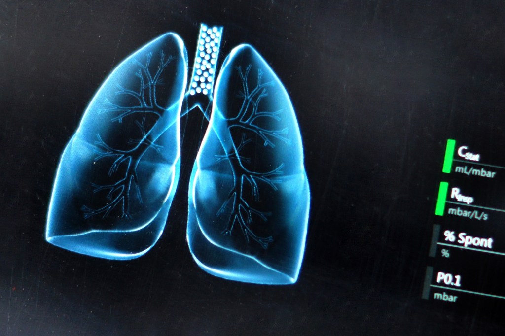 Lung illustration