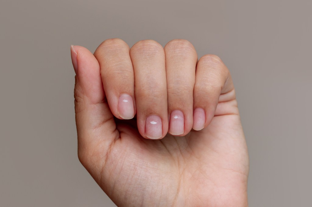 White spots on fingernails