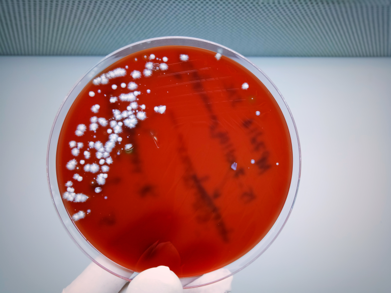 Candida growth on an agar plate