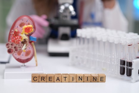 Understanding High Creatinine on Keto