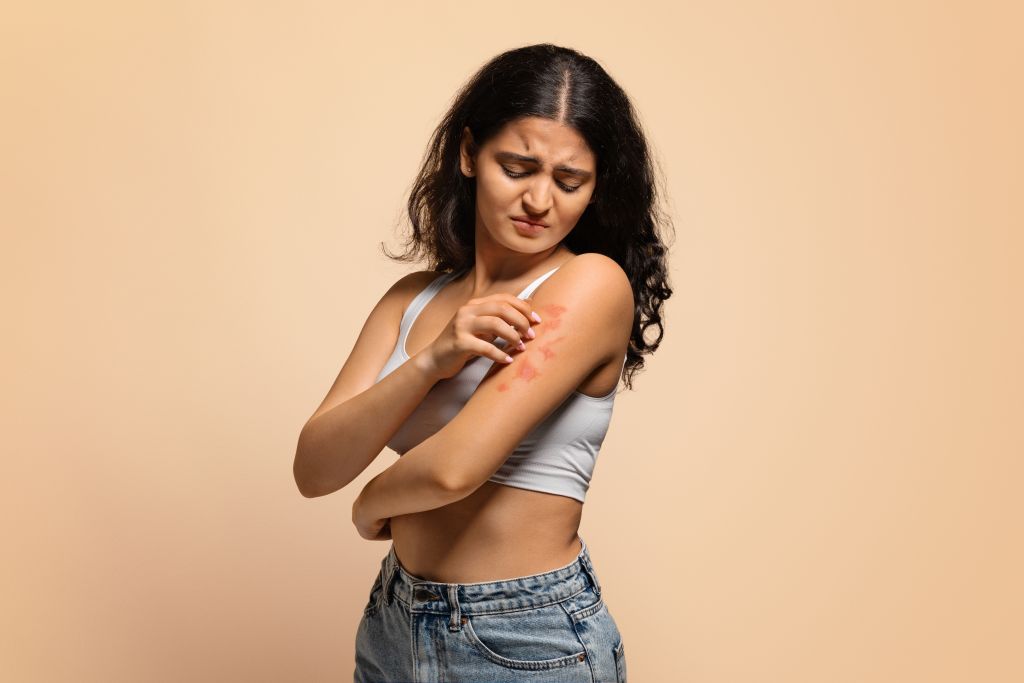 Woman with a skin infection
