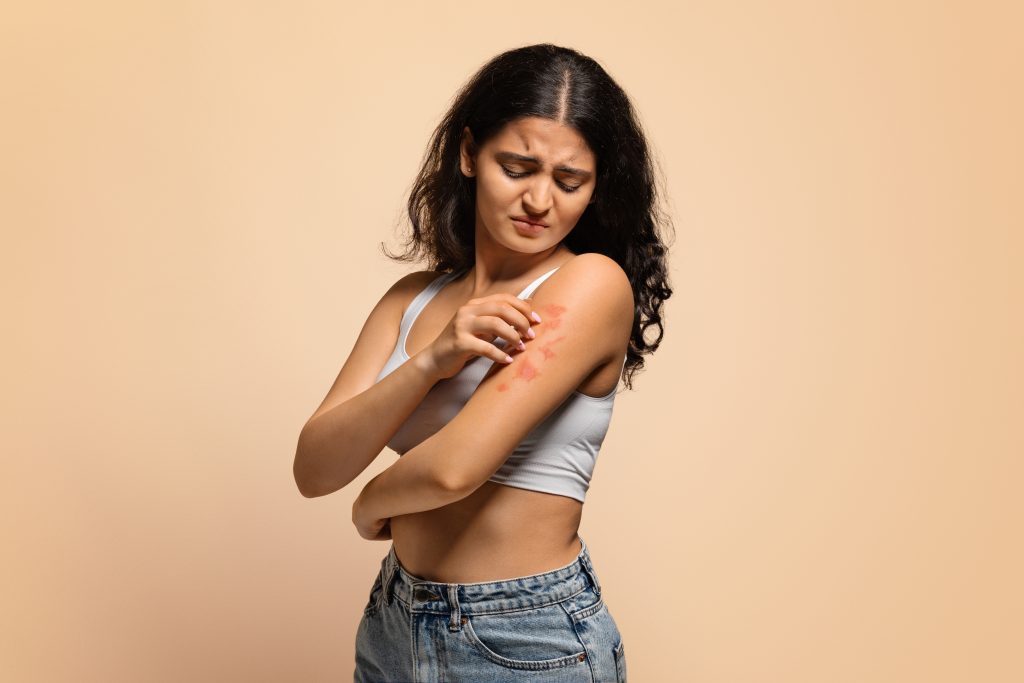 Woman with a skin infection