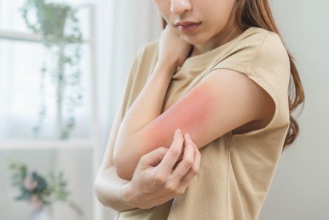 5 Causes of Itching and How to Get Relief