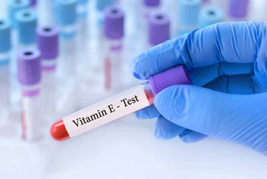 Vitamin E blood test