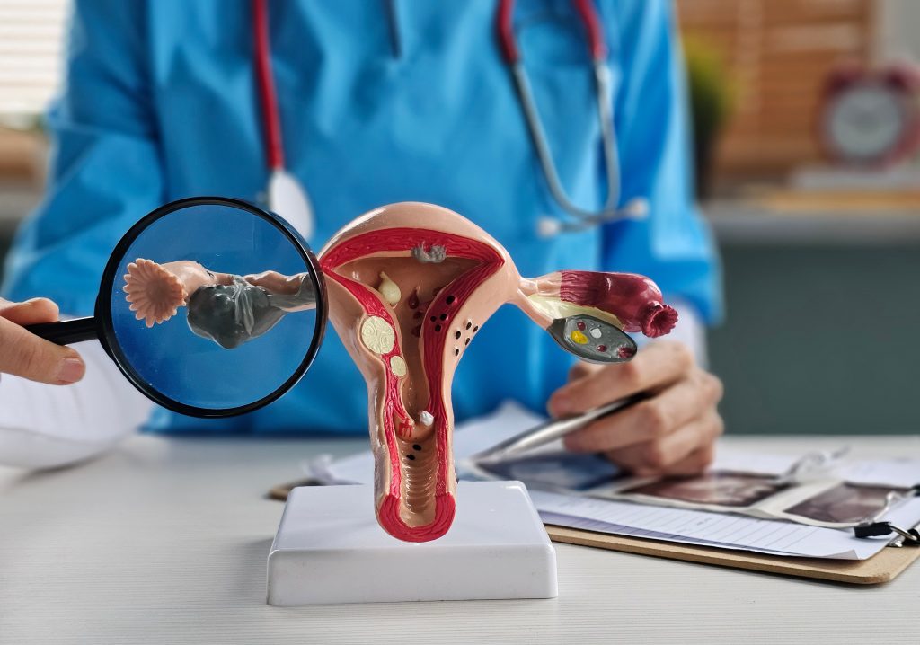 Doctor with an ovary model