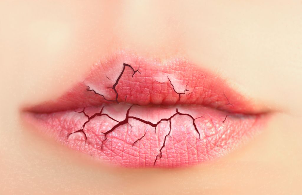 Dry lips illustration  