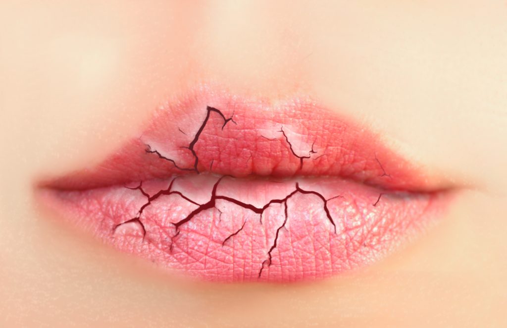 Dry lips illustration  