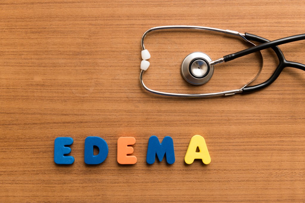 The word edema and a stethoscope