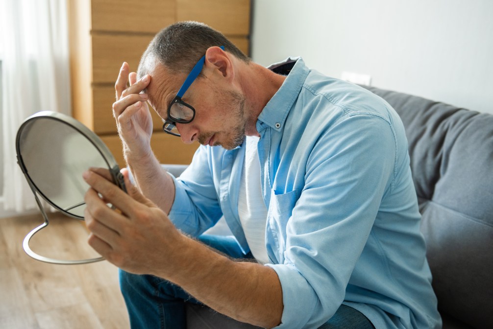 Top Causes of Hair Loss and Natural Solutions