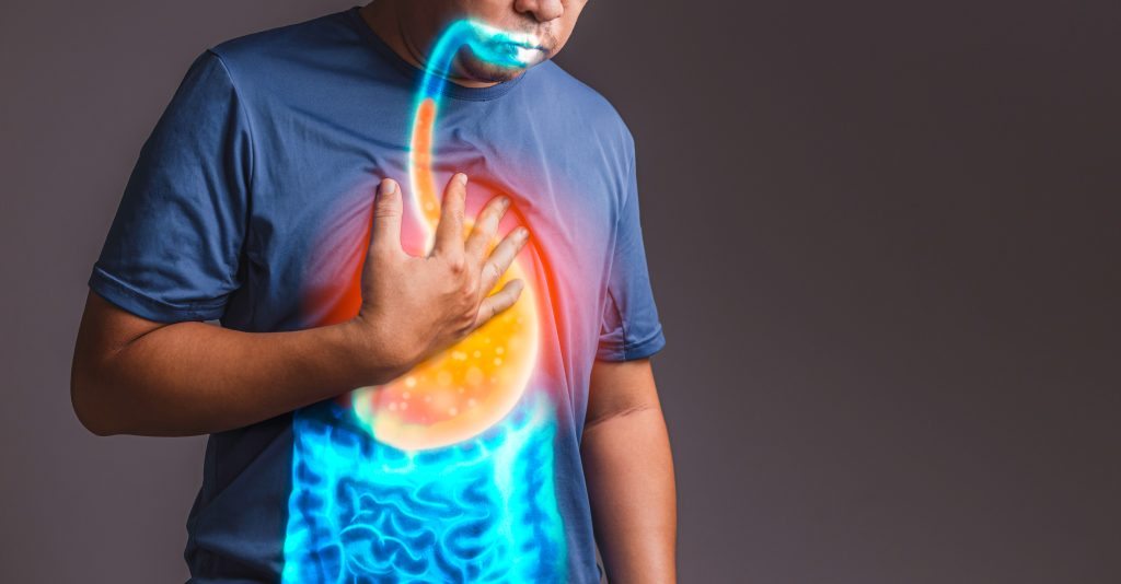 Man with acid reflux