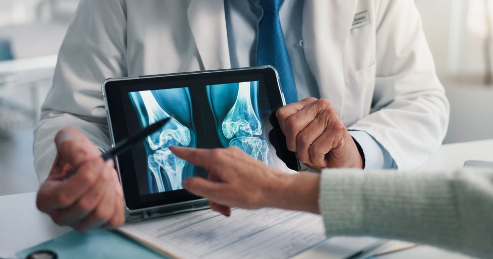 Doctor reviewing X-ray