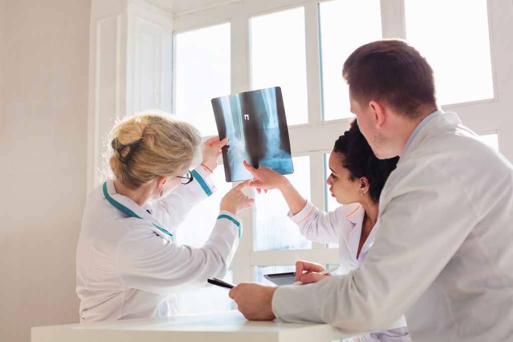 Doctors observing X-ray