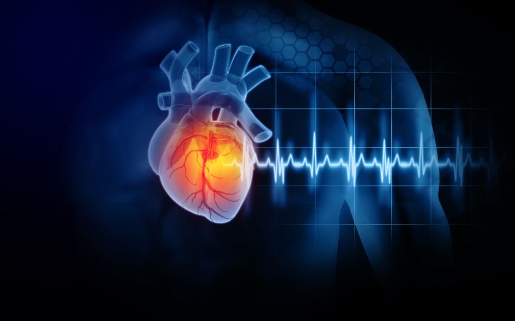 Palpitations graph  