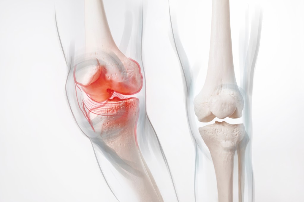 Bone illustration