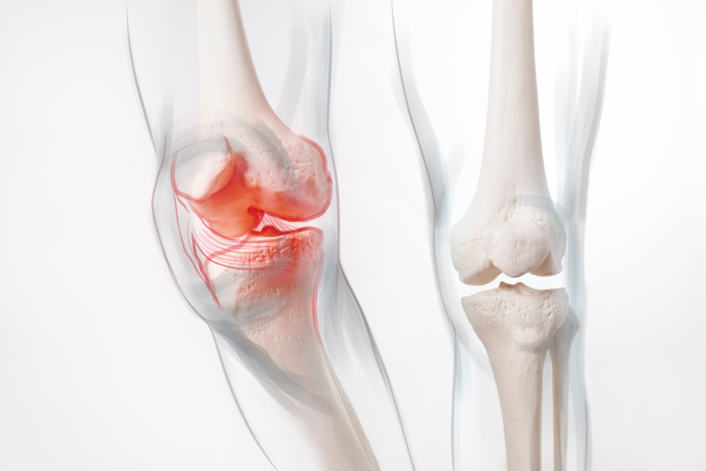 Bone illustration