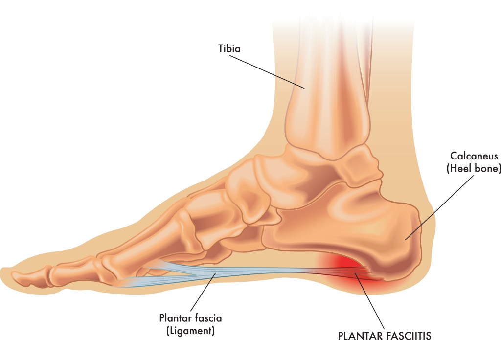 plantar fascia