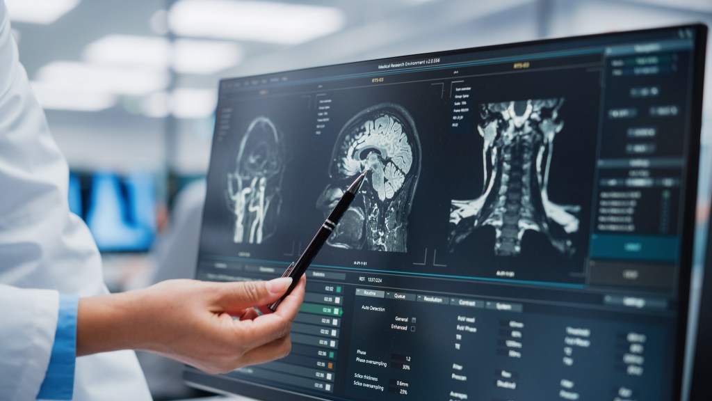 Neurologist pointing at brain scan