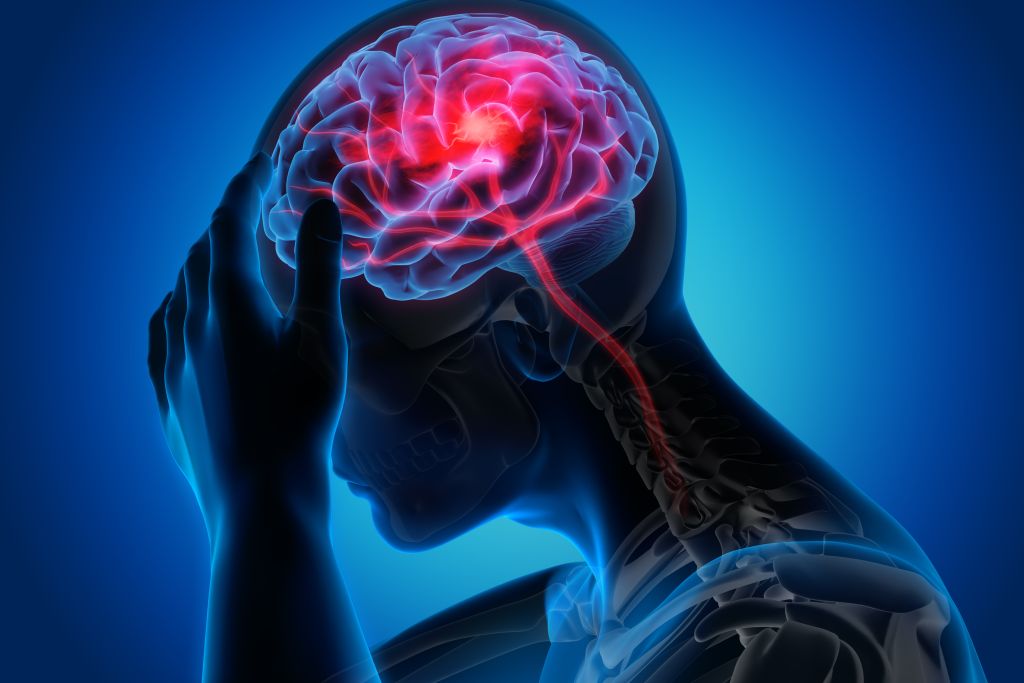 Brain trauma illustration