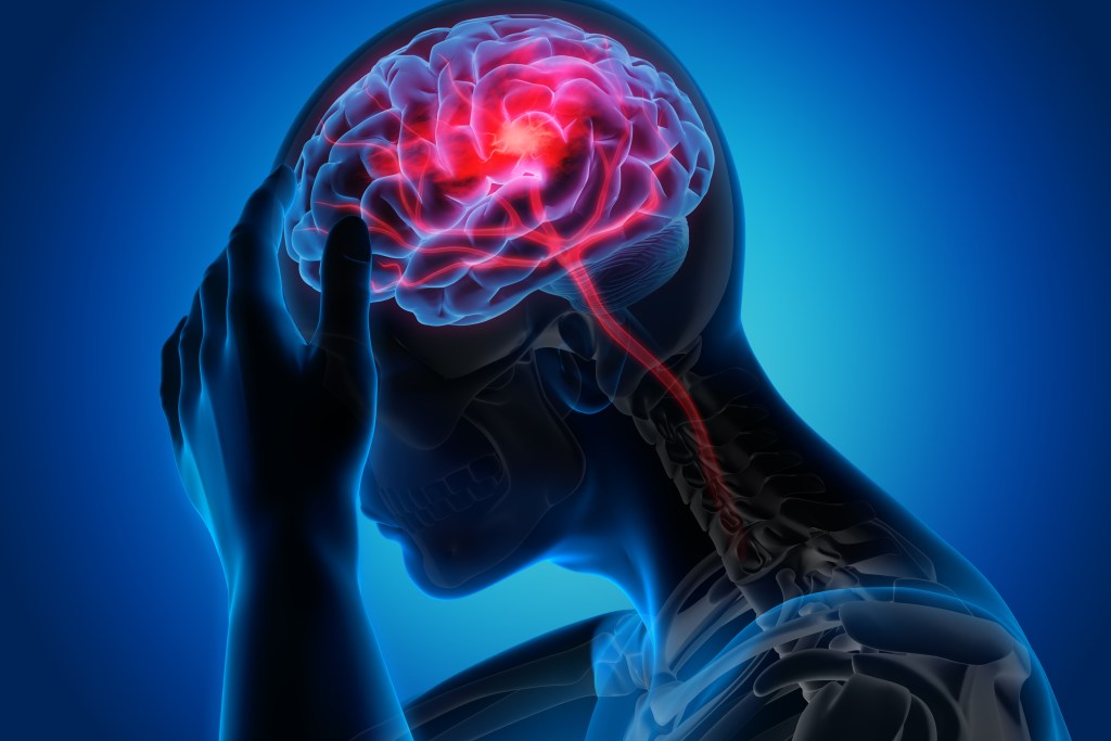 Brain trauma illustration