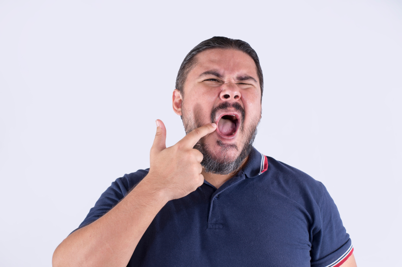 Man with cracked corners of the mouth