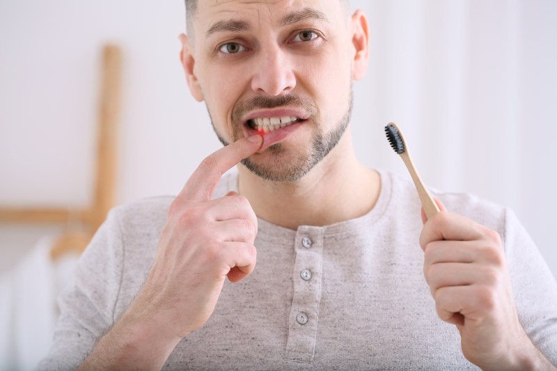 Man with bleeding gums
