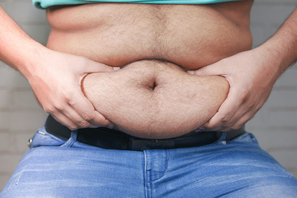 Man with belly fat