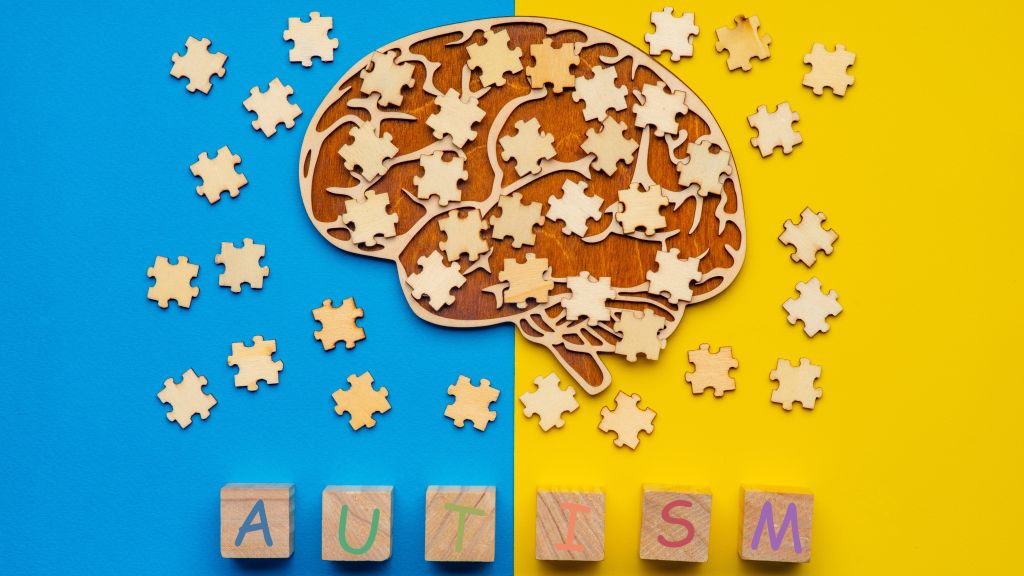 Brain puzzle concept