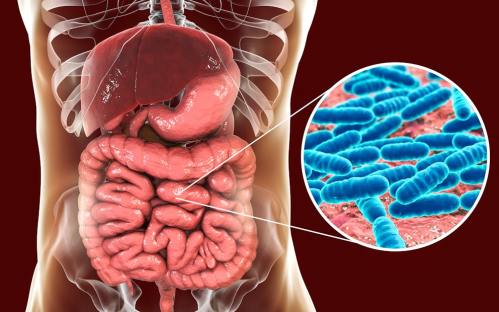 Probiotics on Keto: Benefits, Strains, and Dosage